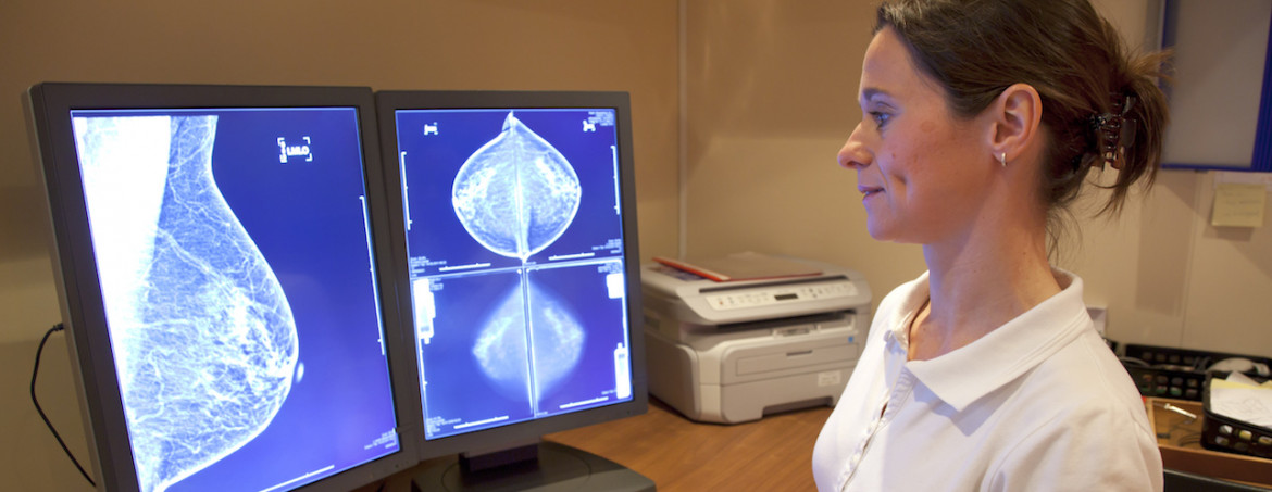 Mammography Service