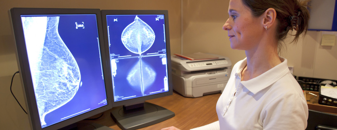 Understanding Mammograms