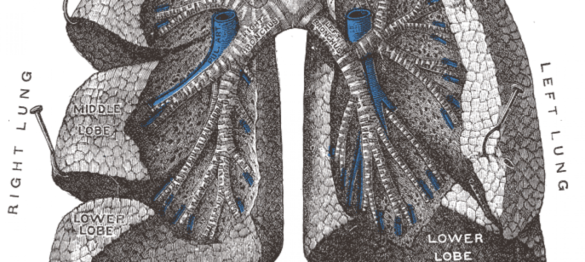 cystic fibrosis