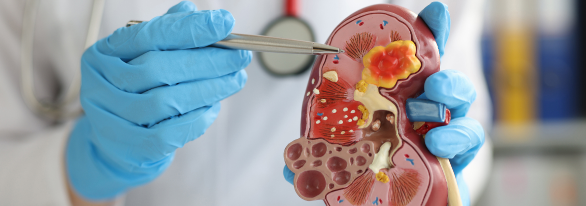 health care provider holding a model cross section of a kidney
