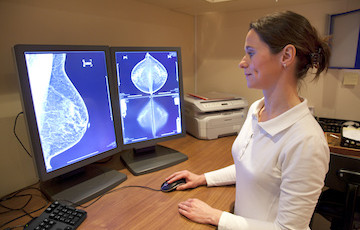 Mammography Service