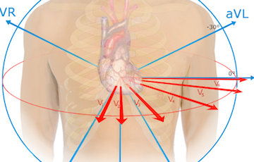 electrocardiogram 