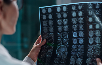 doctor looking at a print out of scan