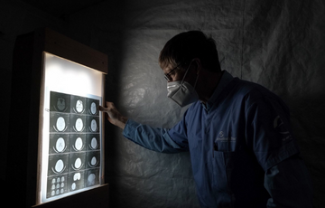 Dr. Potts reviewing an MRI film on a homemade viewing box 