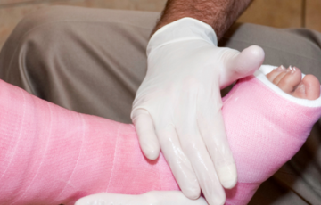 a leg in a pink plaster cast